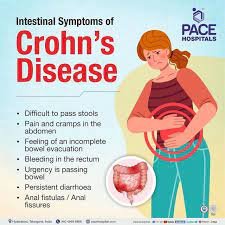 Crohn's Disease