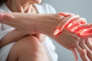 Rheumatoid Arthritis